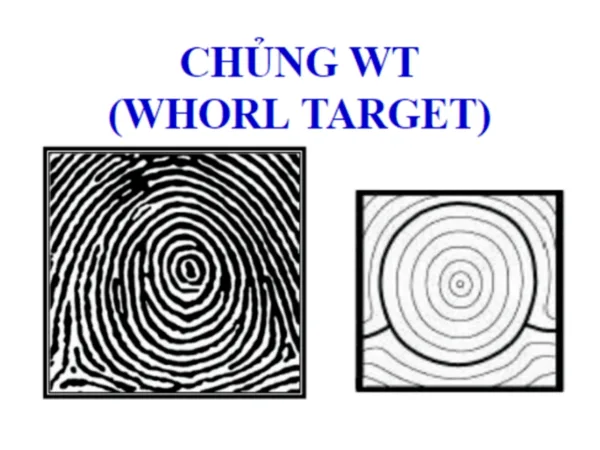 Chủng vân tay WT