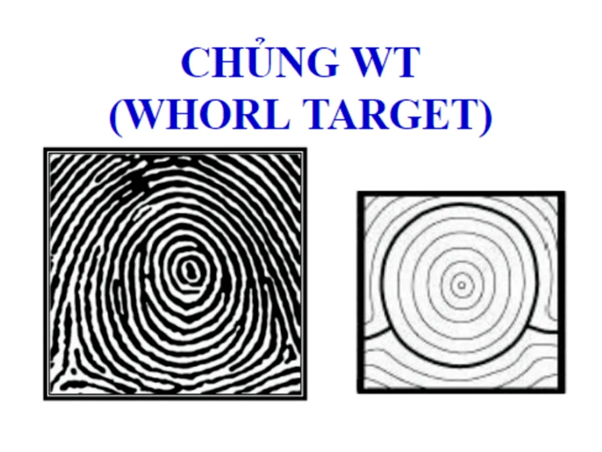 Chủng vân tay WT