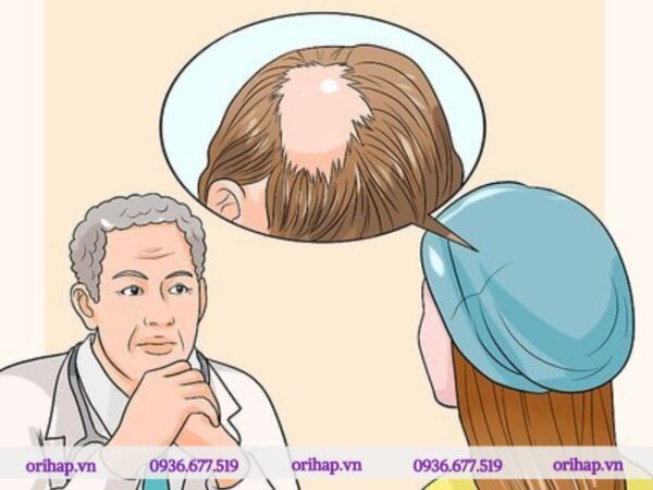 Để chẩn đoán chính xác, các bác sĩ cần đánh giá hành vi nhổ tóc của bệnh nhân trong một thời gian dài và xem xét các yếu tố tác động tâm lý đi kèm.