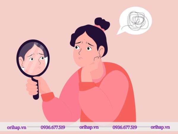 Rối loạn biến dạng cơ thể thường khởi phát trong giai đoạn tuổi vị thành niên, với độ tuổi trung bình là 16-17 tuổi.