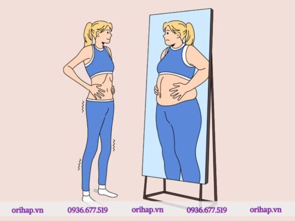 Tìm hiểu về rối loạn dị dạng cơ thể